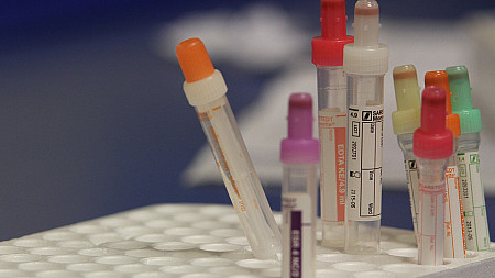 USA: Biskupi przeciw obowiązkowemu finansowaniu in vitro