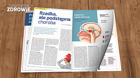 Rzadka, ale podstępna choroba